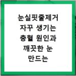 눈실핏줄제거 자꾸 생기는 충혈 원인과 깨끗한 눈 만드는 법